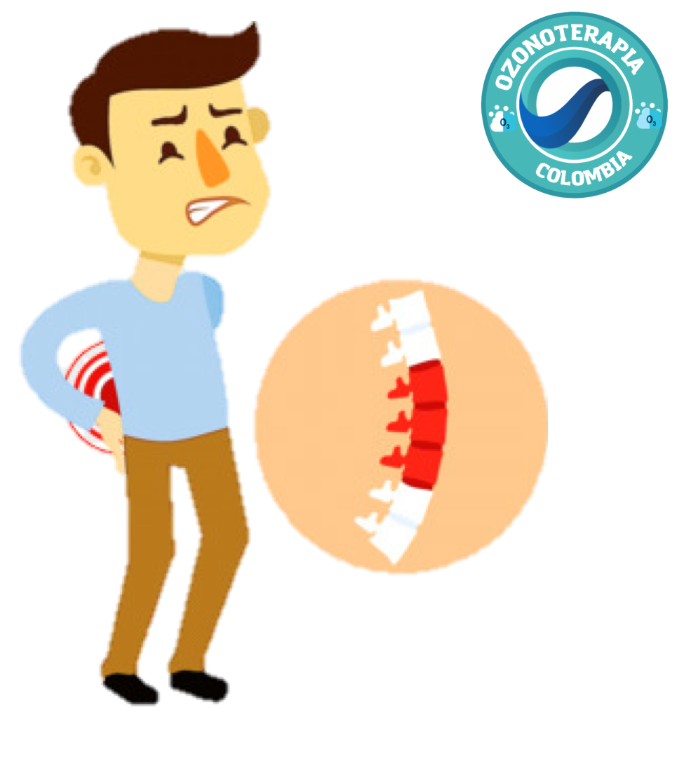 Dolor de espalda Ozono Dolor de espalda Ozono